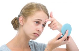 How to Get Rid of Acne Overnight