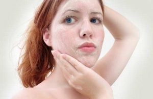 How To Get Rid Of Dead Skin Cells From Body
