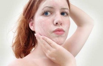 How To Get Rid Of Dead Skin Cells From Body