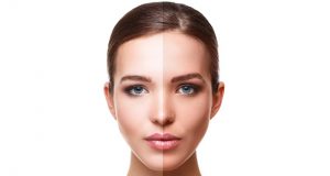 15 Sure-Shot Home Remedies To Remove Sun Tan!