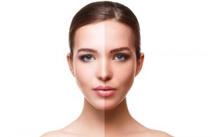 15 Sure-Shot Home Remedies To Remove Sun Tan!