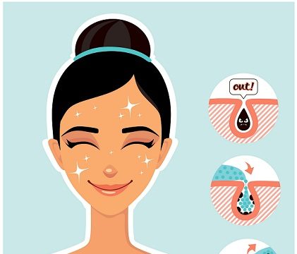 How To Clear Acne?